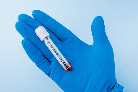 A positive blood test result for a new rapidly spreading coronavirus. concept of medicine and health...