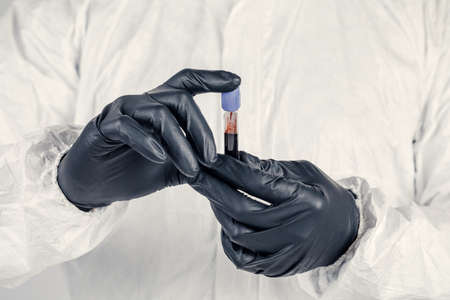A test tube in a man's hand close-up , a man in a medical mask holding a bottle of red liquid. Concept of blood samples , medical and chemical research.の写真素材