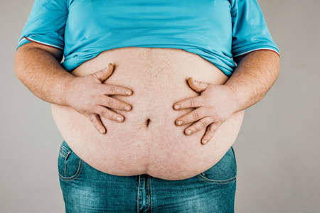 Overweight of a person's body with hands touching the abdomen. The concept of obesity.の写真素材