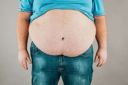 Overweight of a person's body with hands touching the abdomen. The concept of obesity.の写真素材