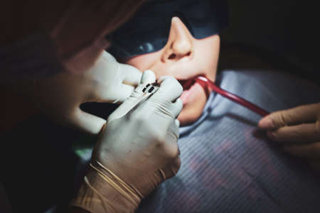Closeup photo shoot of little child which gets dental operation by dentist and her assistant.の写真素材