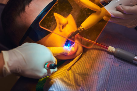 Closeup photo shoot of little boy in protective glasses which gets dental operation with uv light...