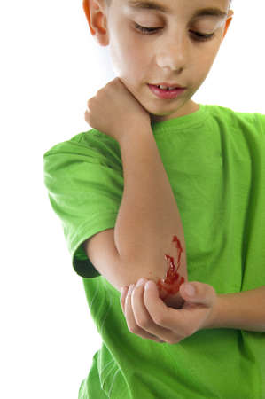 a young boy with a painful elbow on whiteの写真素材