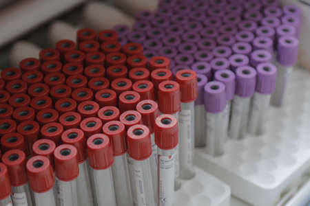 Blood tests are seen at a blood donor transfusions center, in Bucharest, capital of Romania, 31 October, 2015. Colectiv blaze killed 28 and burnt over 160 people.のeditorial素材