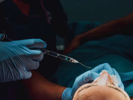 Surgeon doctor doing rhinoplasty surgery inside operating room at modern hospital - Focus on patient headの写真素材