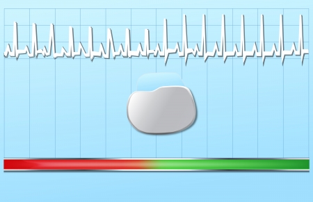 The Pacemakerのイラスト素材