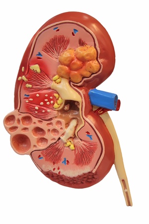 Kidney