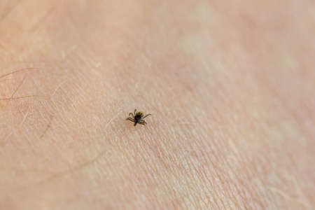  Macro shot of red tick, a bloodsucking parasitic arachnid of the family Ixodidae and carrier of...