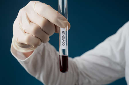 Hand of a medical doctor holding a glass test tube filled with patients blood to be tested for highly lethal and infectious Corona virus.の写真素材