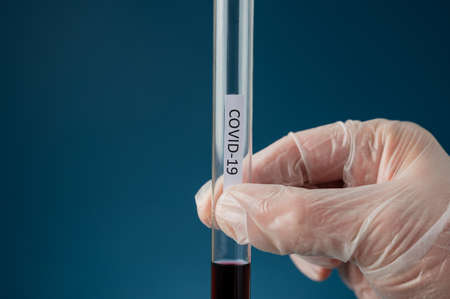 Hand of a doctor wearing protecting glove holding a glass test tube with blood sample and a Covid 19 sign on it.の写真素材
