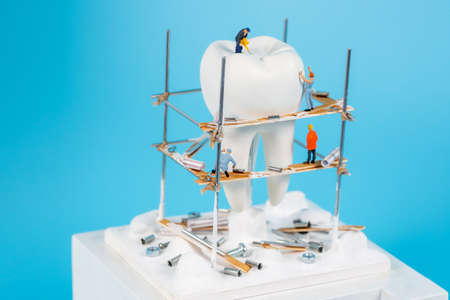 Moscow, Russia - 9th Matra 2021: A model of a human tooth and an art installation of small figures around it. Tooth reconstruction, dental concept.のeditorial素材