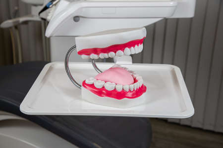 Plaster mock-up of the jaw with gums and teeth on the table. Artificial jaw, visual aid for dentists...