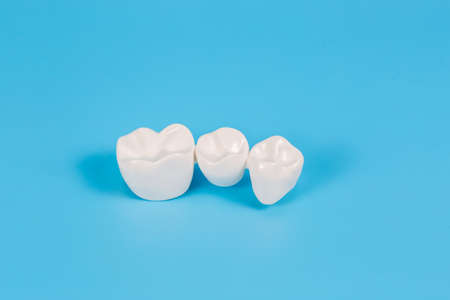 Plastic dental crowns, imitation of a dental prosthesis of a dental bridge for three teeth on a blue background.の写真素材