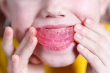 Six-year old caucasian girl shows myofunctional trainer. dental tariner is made to help equalize...