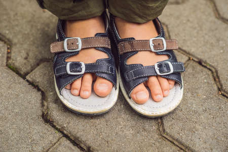 children's orthopedic shoes on the boy's feet.の写真素材