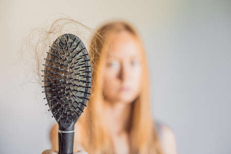 Hair loss in women concept. A lot of lost hair on the comb