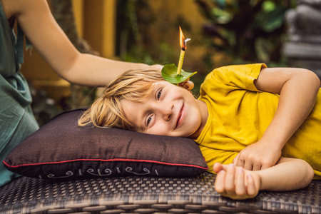The boy gets a procedure with an ear candle, childrens ears health, good hearing, earwaxの写真素材