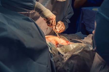 Two doctors performing an operation in the operating room. The surgeons are focused and precise,...