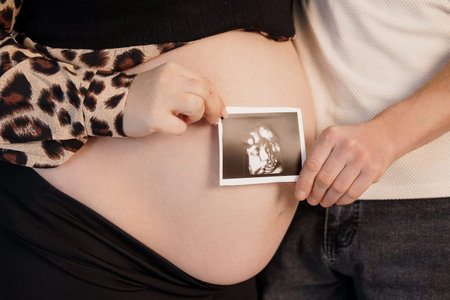 A pregnant woman gently holds an ultrasound image on her bare belly while her partner stands close,...