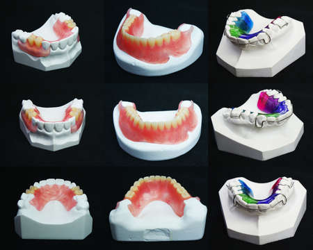 The image of dentures