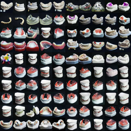 The image of dentures
