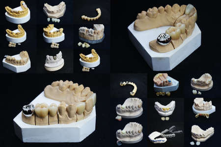 The image of dentures