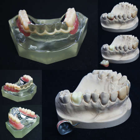 The image of denturesの写真素材