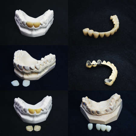 The image of dentures