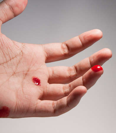 Hand in bloodの写真素材