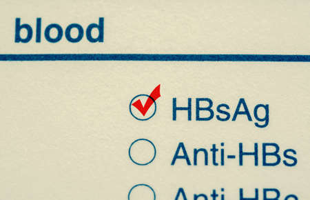 Close up check mark Hepatitis B virus test form.の写真素材