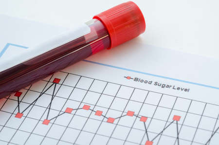 Sample blood for screening diabetic test in blood tube on blood sugar control chart.の写真素材