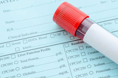 Blood tube for test with blank label and blood in syringe on request form laboratoryの写真素材