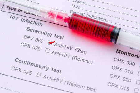 Sample blood in syringe on HIV infection screening test form.の写真素材