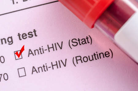 Sample blood collection tube with HIV test label on HIV infection screening test form.の写真素材