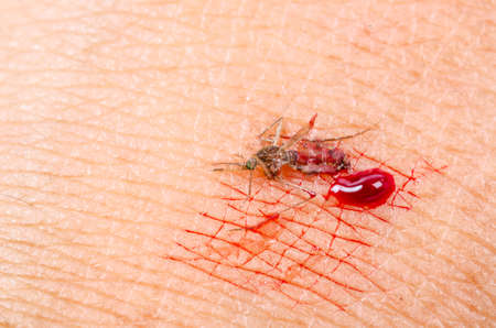 Dead Anopheles mosquito on skins human - dangerous vehicle of infection malaria.の写真素材