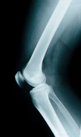 Knee bone anatomy x ray.の写真素材