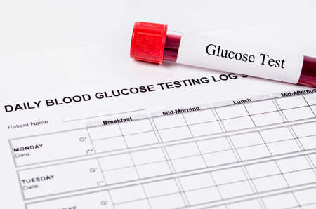 Daily blood glucose testing and sample blood in tube and syringe. Blood sugar control concept.の写真素材