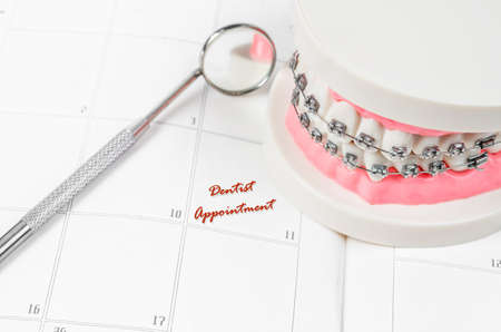 Tooth model with metal wire dental braces with dentist appointment on a calendar. Regular checkups are essential to oral healthの写真素材