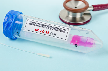 Tube containing nasopharyngeal swab for coronavirus or COVID-19 test in laboratory.の写真素材