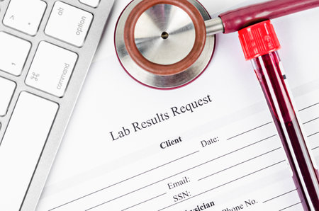 Lab results request and sample blood in tube stethoscope medical.の写真素材