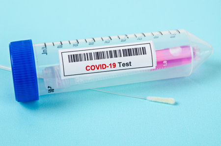 Tube containing nasopharyngeal swab .の写真素材