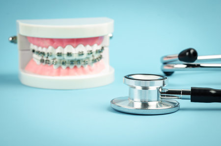 Medicine equipment stethoscope and metal wire dental braces on model teeth on blue background. Health dental care concept.の写真素材