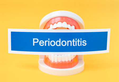 Teeth model with Periodontitis dental disease on yellow background.の写真素材