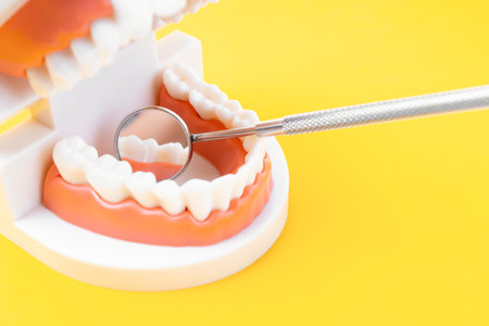 Teeth model showing an implant / dental demonstration teeth study teach model on yellow background.の写真素材
