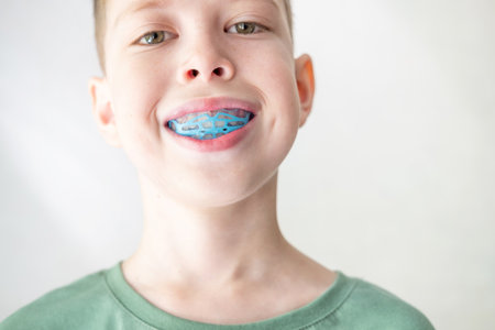 A teenager puts on a training mouthguard for the jaw, close-up. Correction of bite from childhoodの写真素材