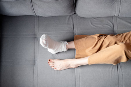Woman with beautiful, long legs and a cast on her right leg with crutches lies on the sofa, top viewの写真素材