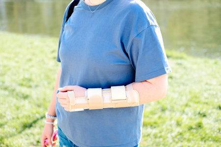 A woman's hand with a beige brace in a summer park, close-up