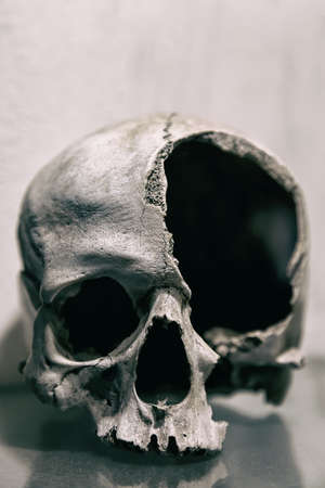 Broken human skull close up. Toned image.の写真素材