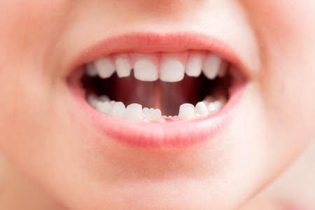 Health care and dental hygiene concept. Close up portrait of little girl without milk teethの写真素材