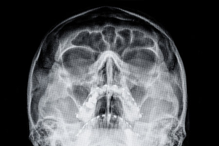 MRI Magnetic resonance image of the human brain and head.